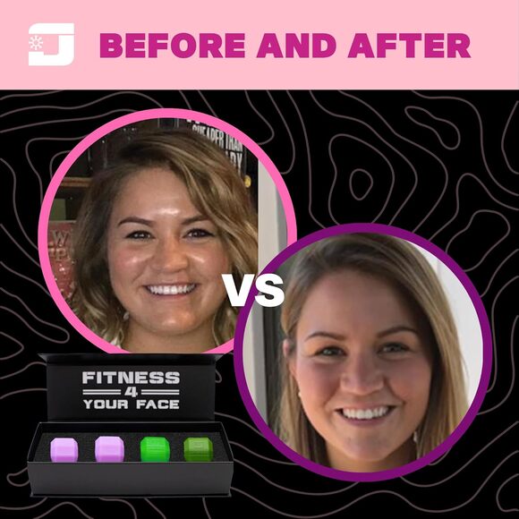 Jawzrsize Women Jaw Exerciser Set, Face Toner, Double Chin Reducer, Neck Fitness - Picture 3 of 14